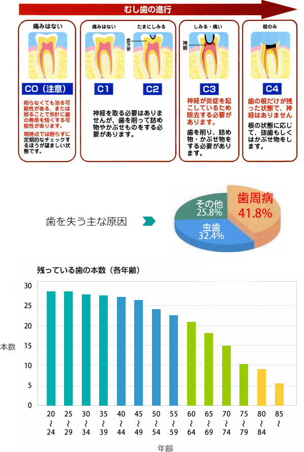 歯周病治療